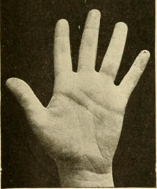hand