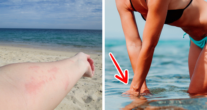 10+ Consejos rápidos de primeros auxilios que podrían salvar tu día