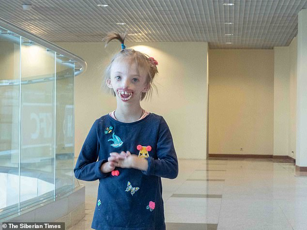 Russian Girl Born Without Chin And Lips Flew To London For A Life