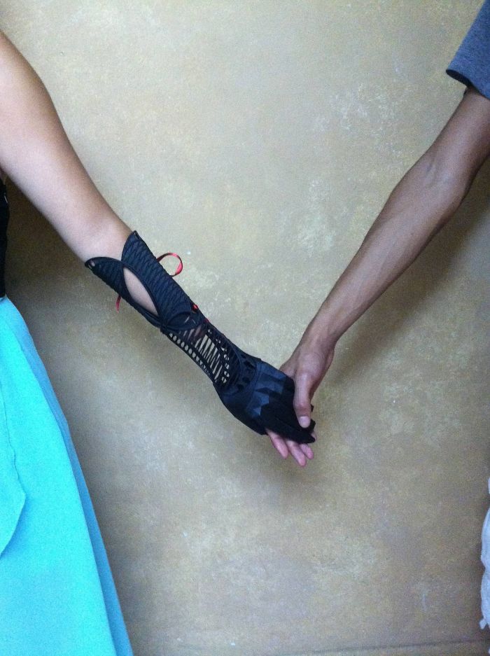 A Prosthetic Arm I Made For A Friend A Prosthetic Arm I Made For A Friend