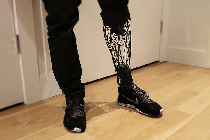 See-Through Prosthetics 3D-Printed From Titanium See-Through Prosthetics 3D-Printed From Titanium