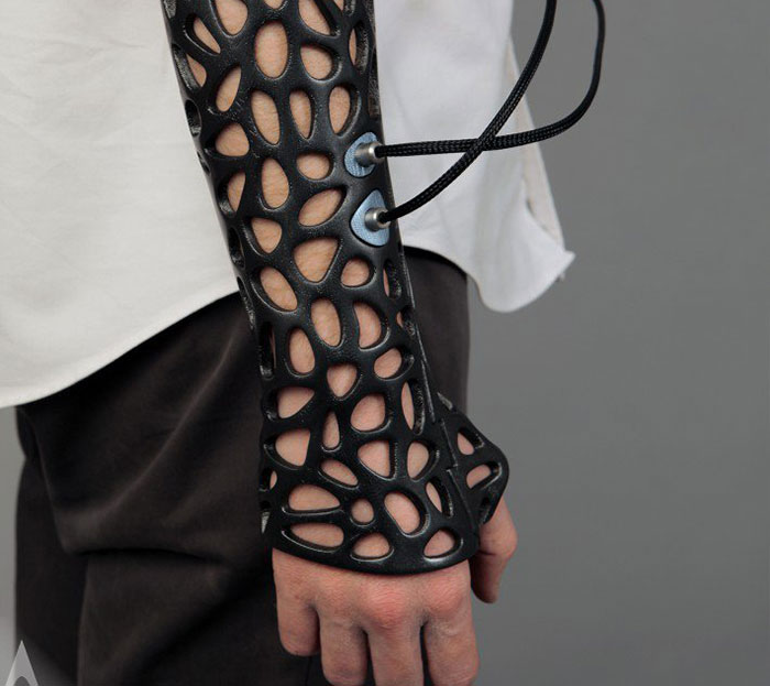 3D-Printed Plastic Cast That Uses Ultrasound To Heal Broken Bones Faster 3D-Printed Plastic Cast That Uses Ultrasound To Heal Broken Bones Faster