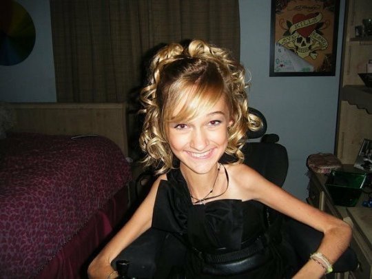 Alex as a youngster when she lost lots of weight 