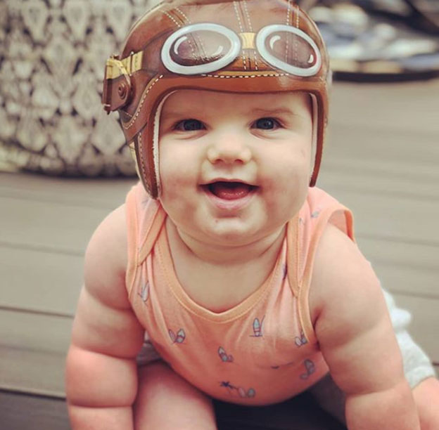 This Woman Turns Corrective Helmets For Babies With Flat Head Syndrome 