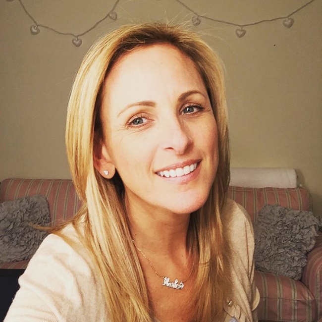 10 Famosos que demuestran que las imperfecciones físicas pueden hacerte más fuerte