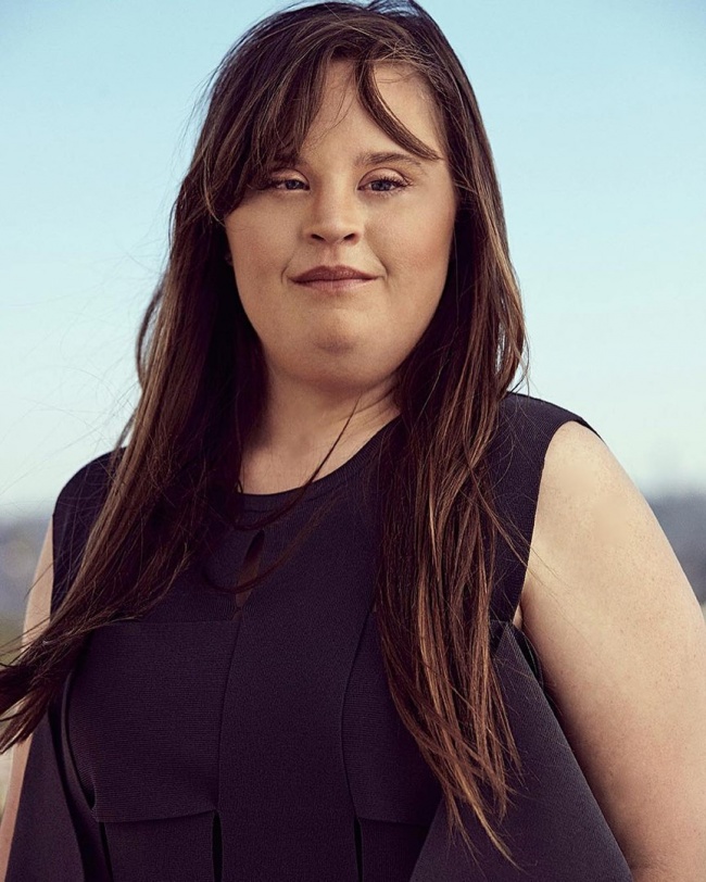 10 Famosos que demuestran que las imperfecciones físicas pueden hacerte más fuerte