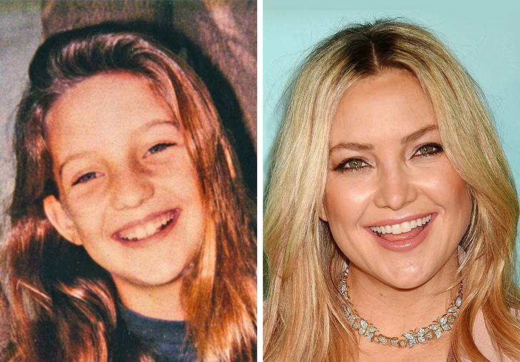 9 Famosas hermosas que pasaron de ser poco agraciadas a convertirse en ídolos de millones