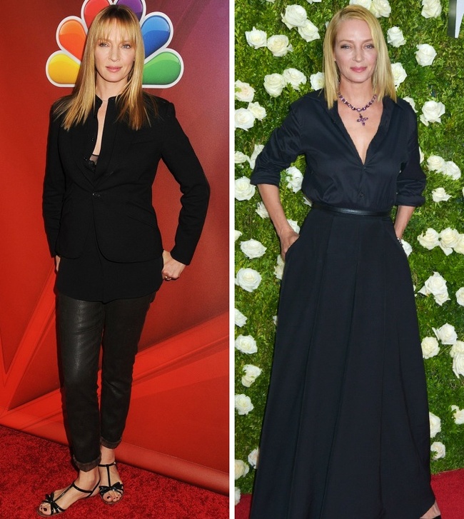 7 Celebridades que convirtieron sus deficiencias en su mejor atributo