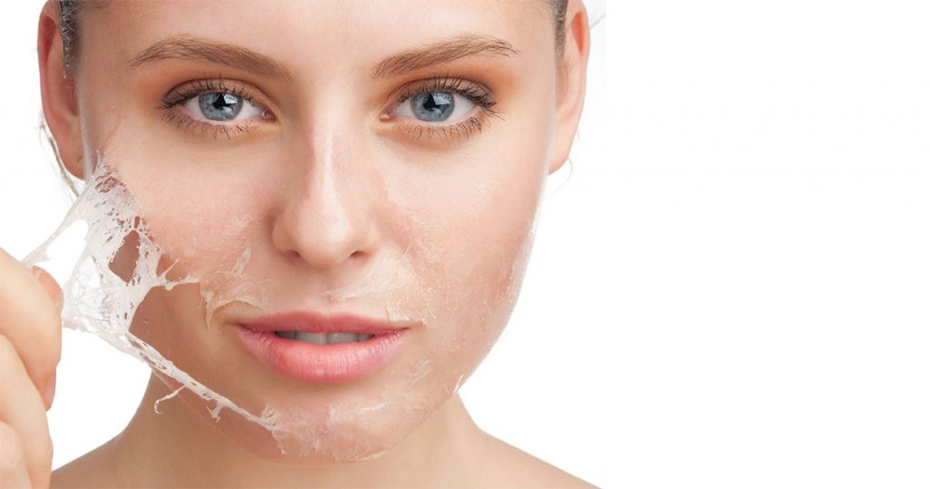 Resultado de imagen de Peeling quÃ­mico