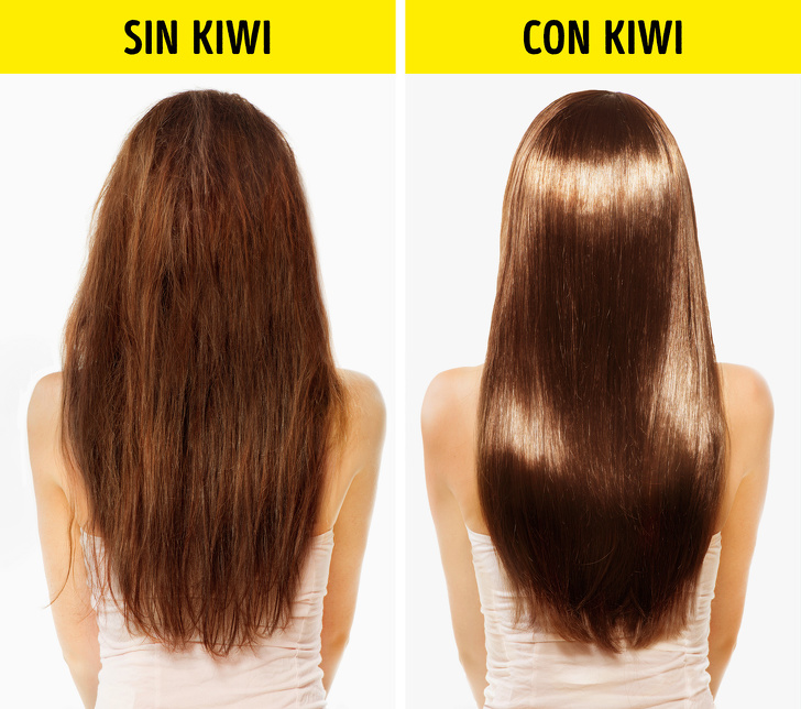 10 Beneficios de comer kiwi todos los días que pueden mejorar tu salud