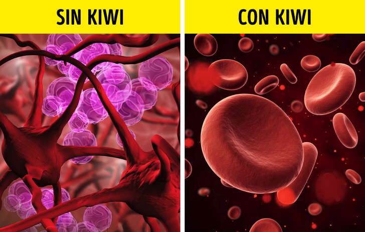 10 Beneficios de comer kiwi todos los días que pueden mejorar tu salud