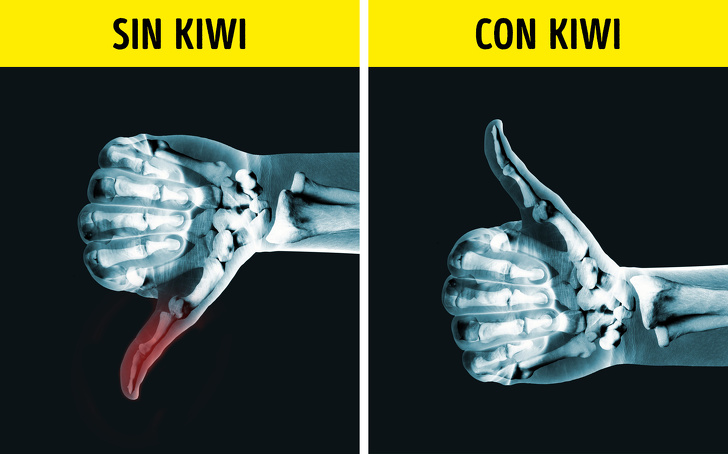 10 Beneficios de comer kiwi todos los días que pueden mejorar tu salud