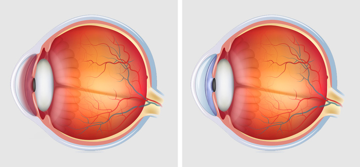 10 Beneficios de comer kiwi todos los días que pueden mejorar tu salud