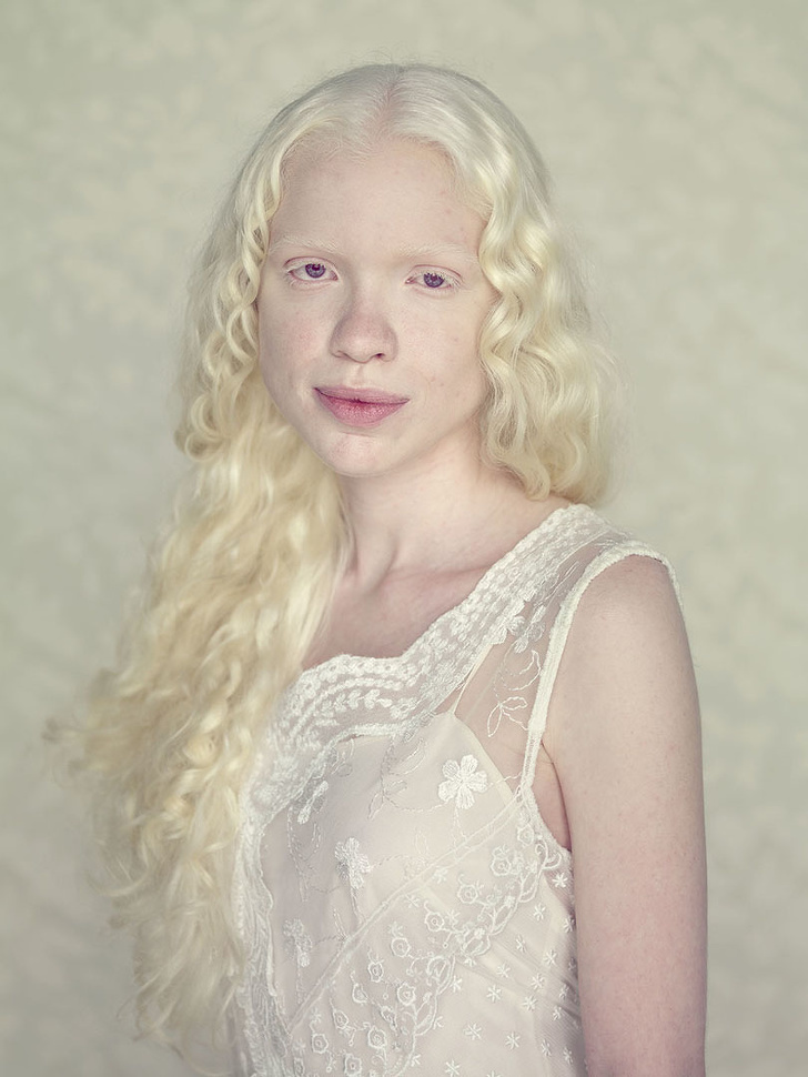 People Can T Stop Loving These Unique Photos Of People With Albinism Small Joys