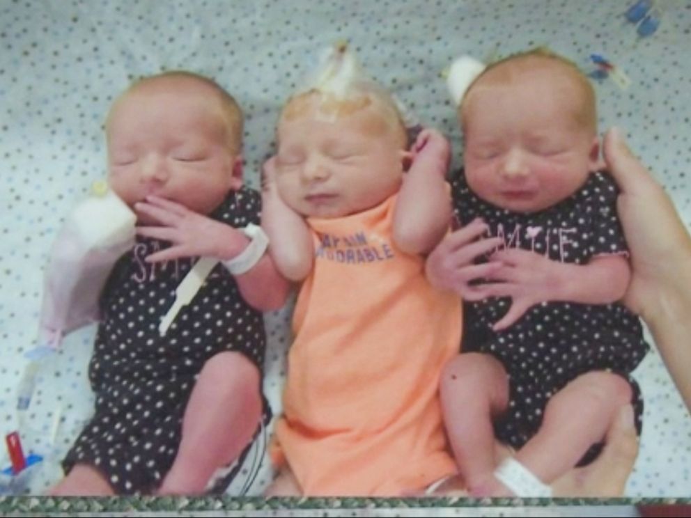 Woman Gave Birth To Triplets Without Realizing She Was Pregnant For 34 ...