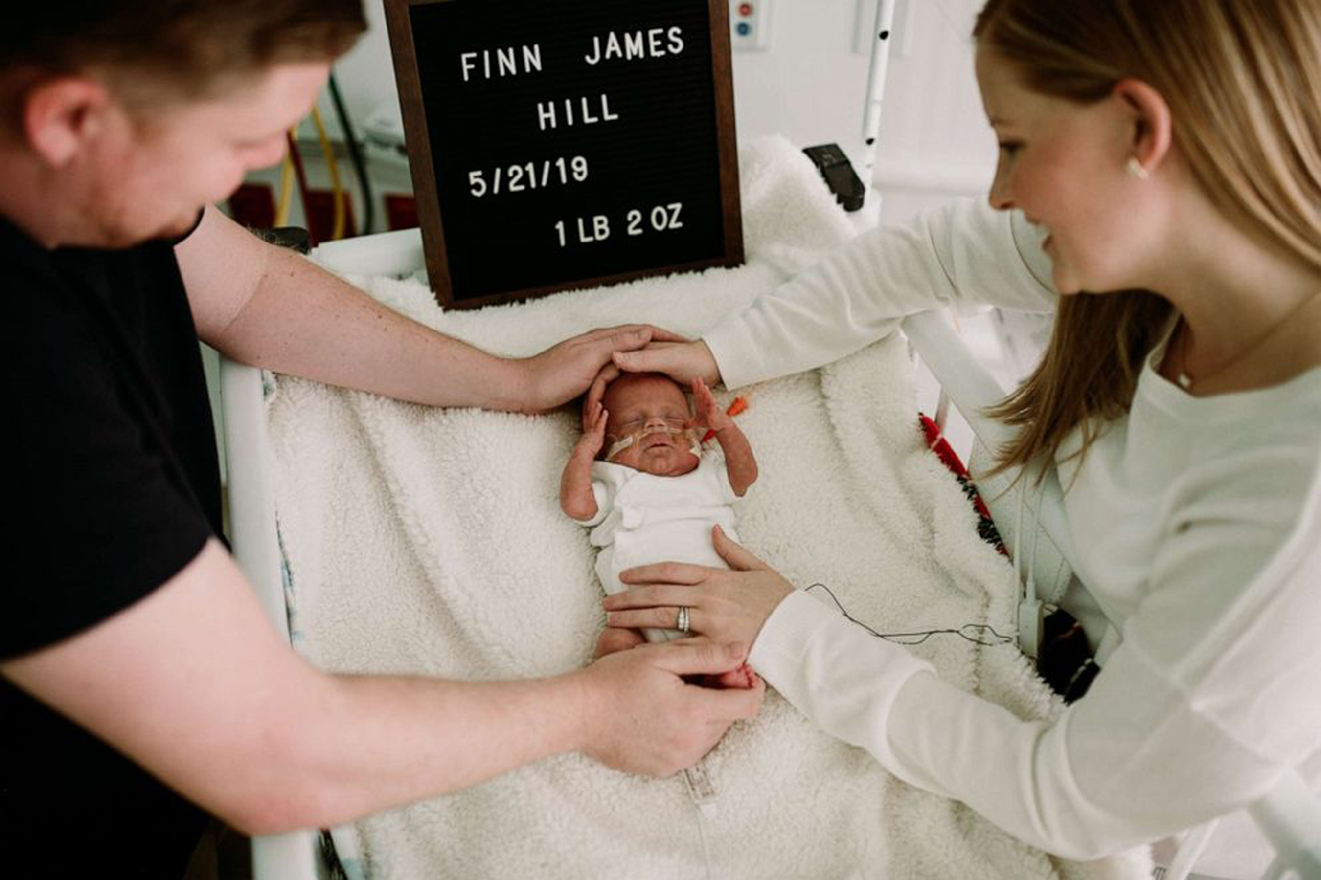 1-pound-micro-preemie-finally-headed-home-after-spending-100-days-in