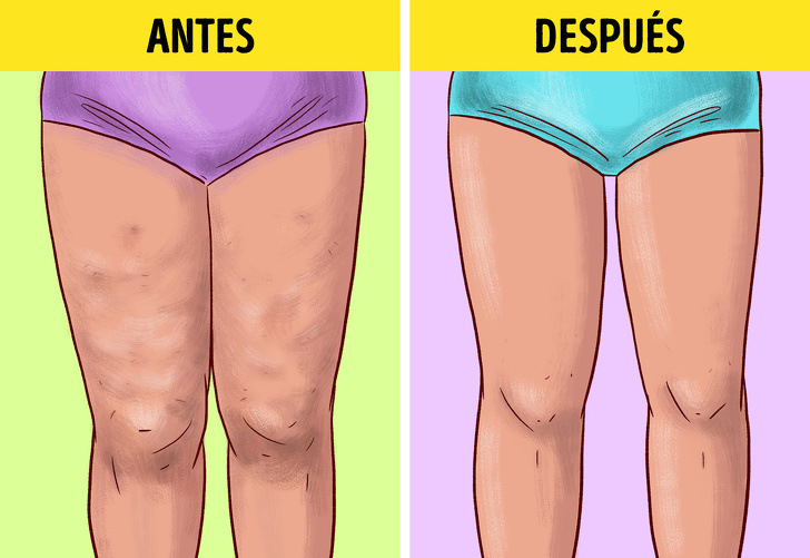 10 Alimentos que puedes incluir en tu dieta para luchar contra la celulitis y algunas recomendaciones para disminuirla