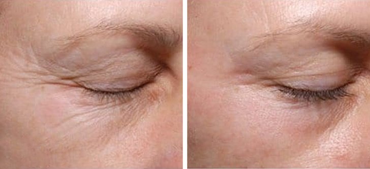 15 Invaluables trucos de cuidado personal que le harán la vida más fácil a cualquier mujer