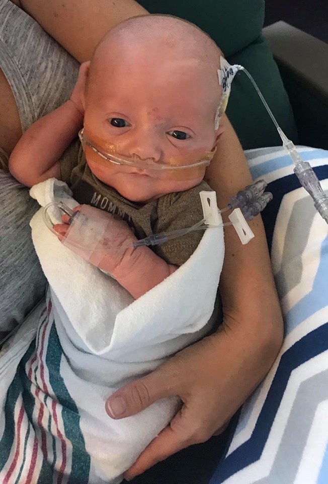 Image may contain: 1 person, stripes and closeup