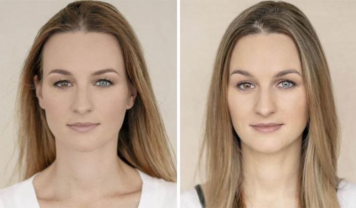 Women-Before-After-Pregnancy-Photography-Vaida-Markeviciute Women-Before-After-Pregnancy-Photography-Vaida-Markeviciute