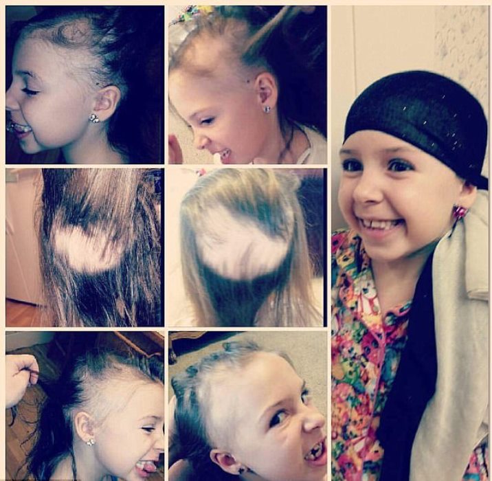 7-Year-Old Girl With Alopecia Has Her Head Covered In Sparkly Jewels At ...