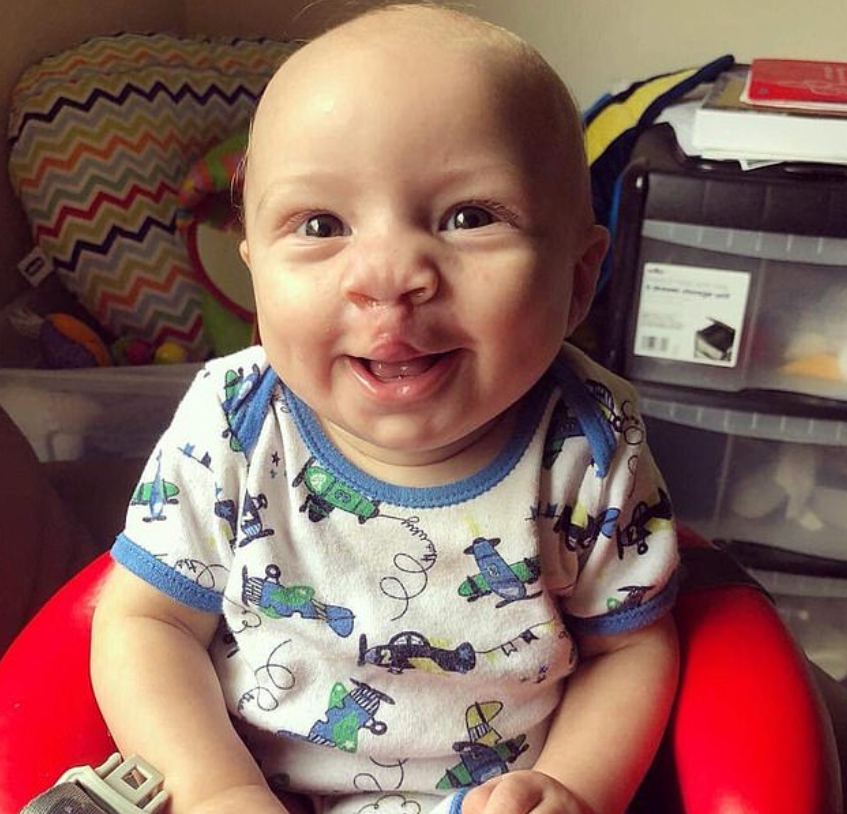 Bébé Sourit à Tout Le Monde Sauf Maman Un bébé de 16 mois a un nouveau sourire après avoir subi deux