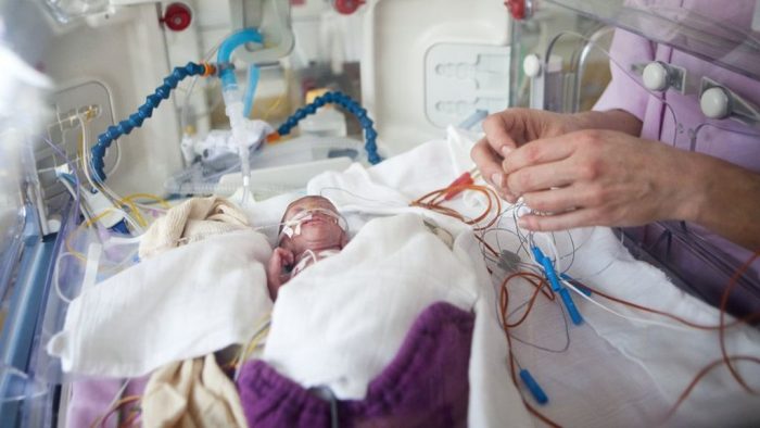 Babies Born As Early As 22 Weeks Will Be Resuscitated, According To New ...