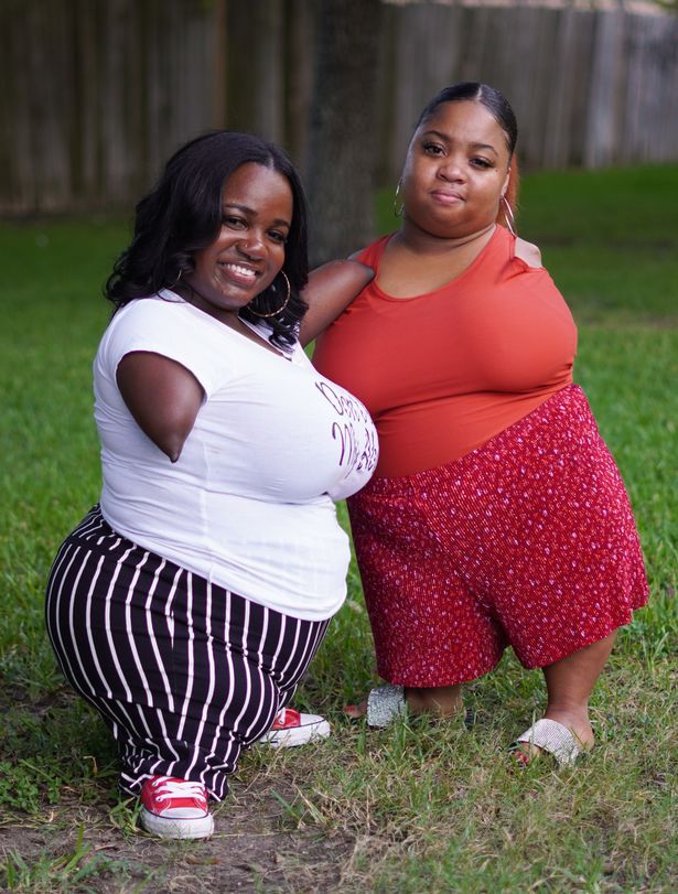 Women Without Limbs Have Become Best Friends After Learning About Each Others Life Story 