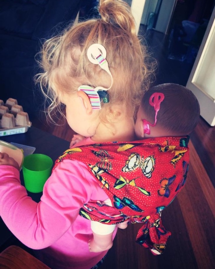 Toy Companies Have Started Making Toys That Encourage Children With Disabilities to Love Themselves