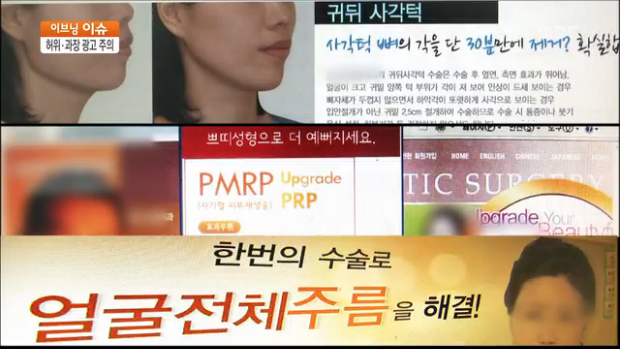 성형외과 과대광고에 대한 이미지 검색결과