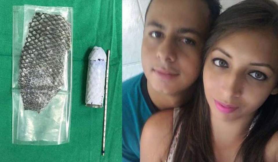 Resultado de imagen de Woman born without vagina gets one made from tilapia fish skin"