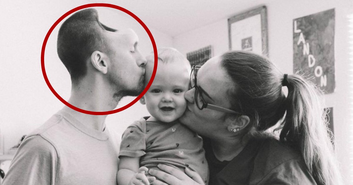 too much energy drink.jpg?resize=1200,630 - Woman Shared Photos Of How Energy Drinks Affected Her Husband Forever