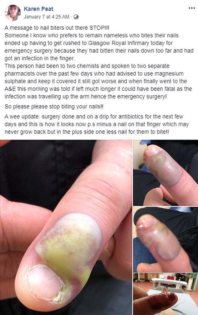 man-rushed-to-hospital-after-contracting-infection-from-biting-nails