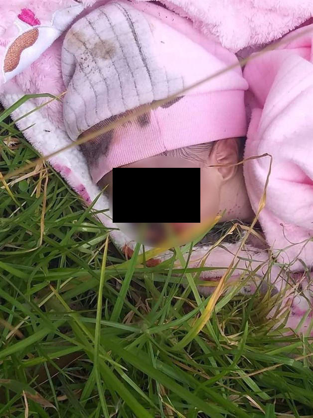 Resultado de imagen de Muere bebé abandonada y devorada por larvas de mosca