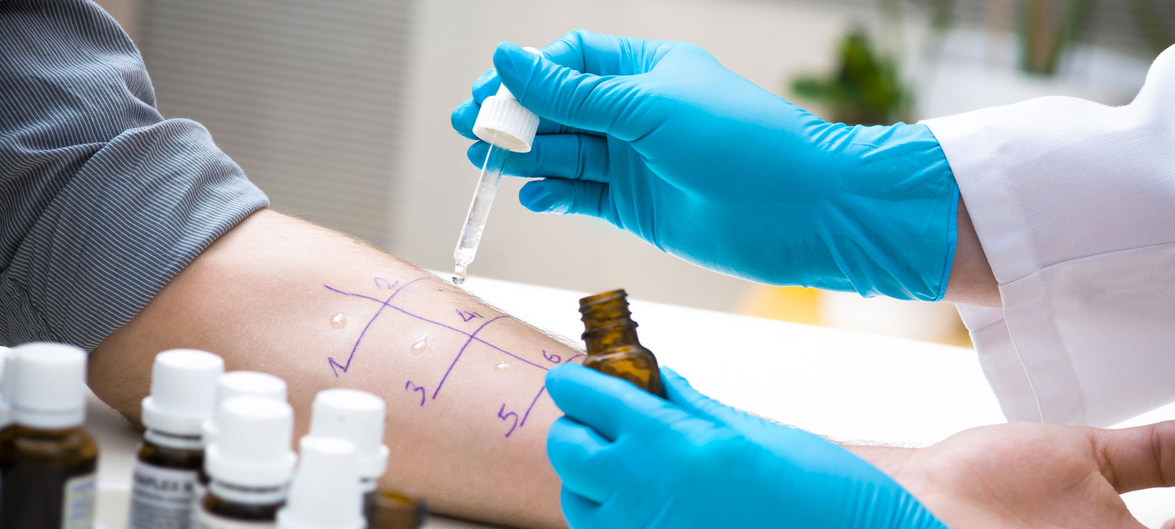 Resultado de imagen de alergia medica