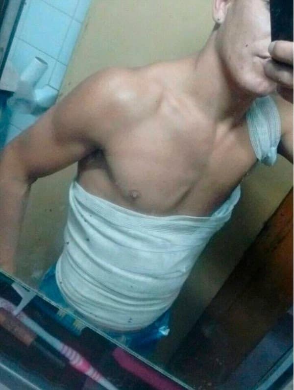 Resultado de imagen de Catriel Gómez quemaduras movil