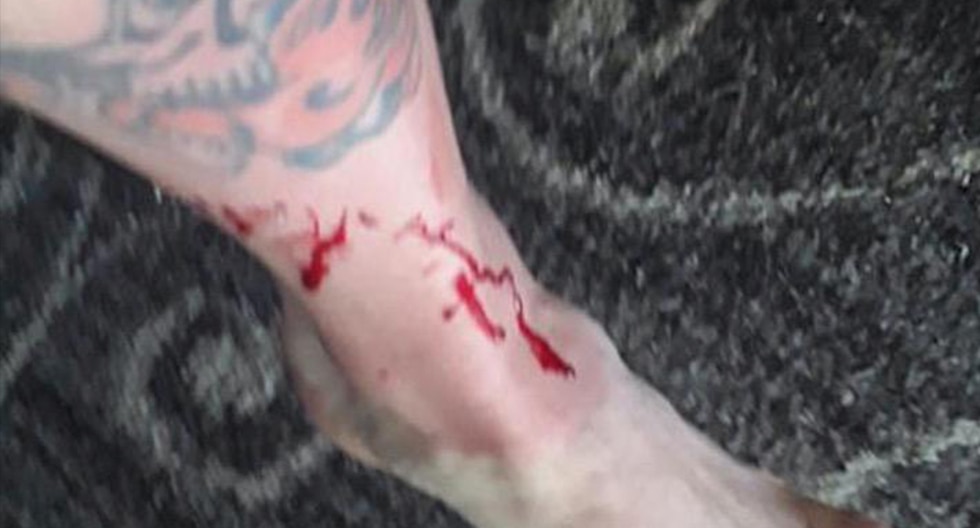 Un perro salva a su dueño de las fauces de un tiburón. La historia es viral en Facebook. (Foto: NBC Bay Area)