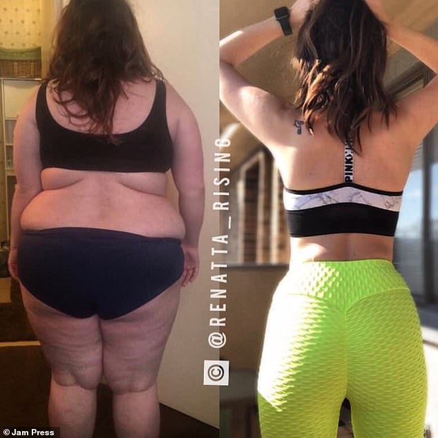 A Woman Who Weighed 290lbs Shed 140lbs After Going On A Ketogenic Regime.