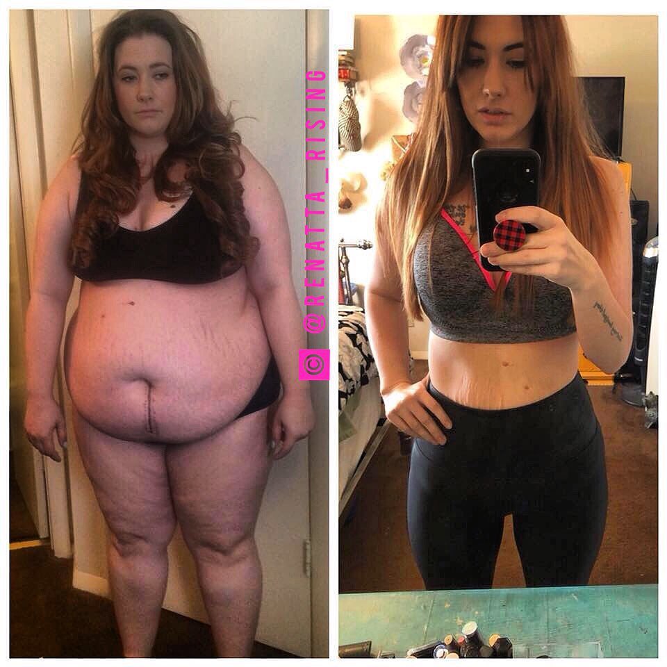 290lbs Woman Lost Over 140lbs After A Humiliating Incident.
