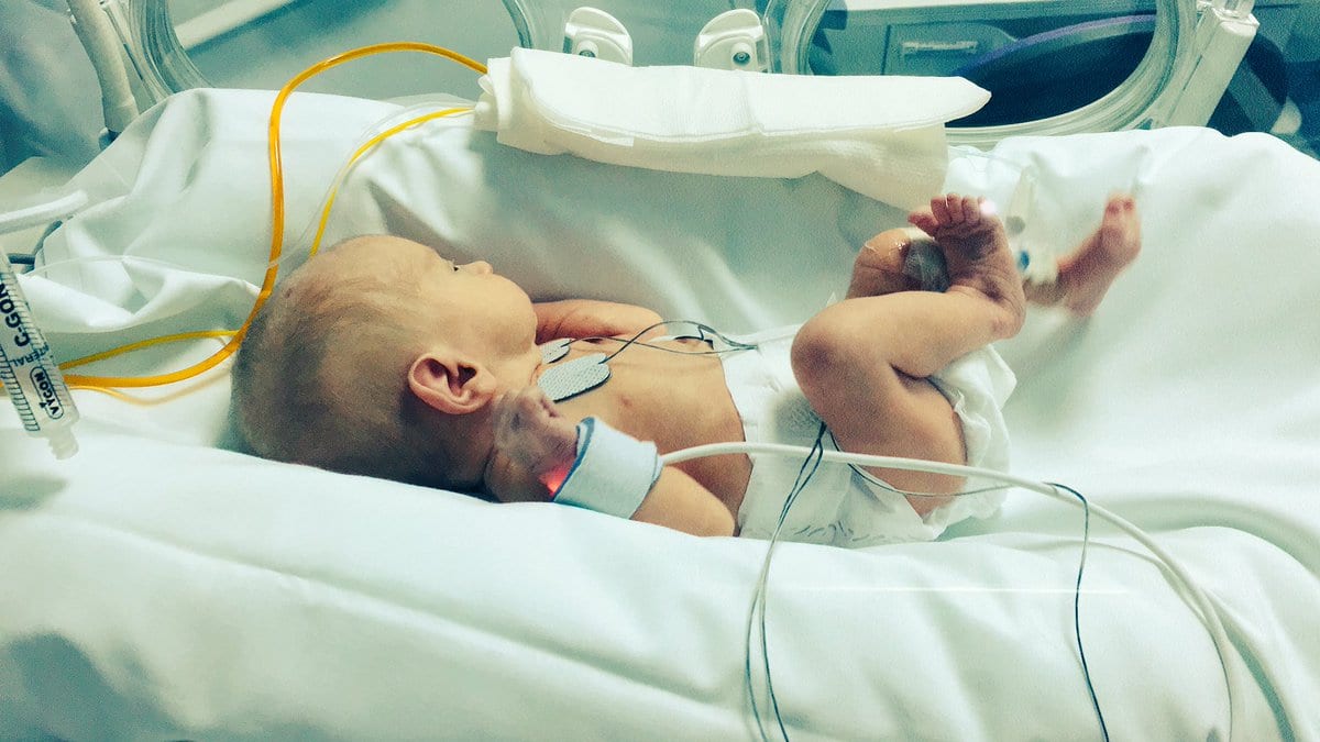 Resultado de imagen de bebe neonato