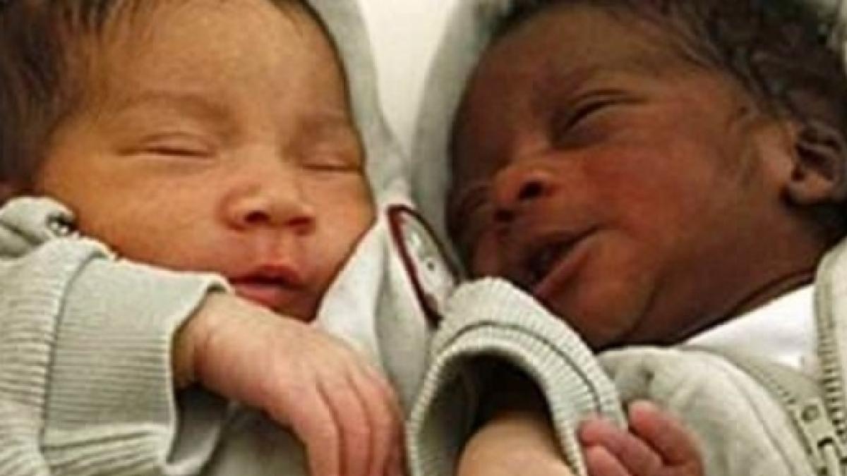 Resultado de imagen de vietnam mellizos de distintos padres