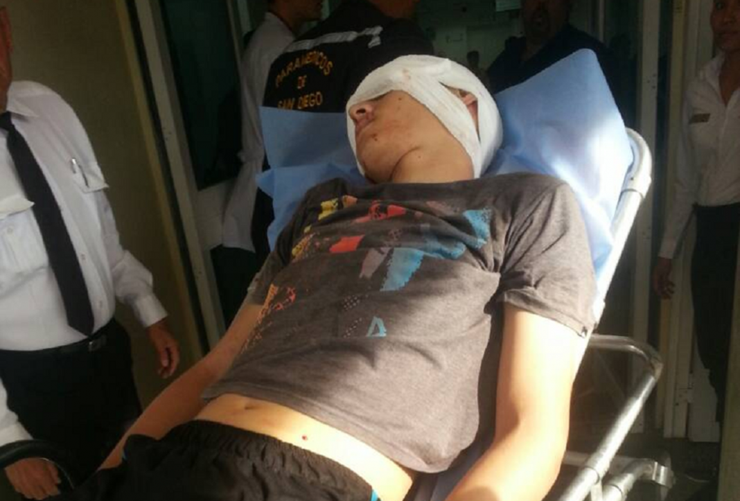 Resultado de imagen de joven herido