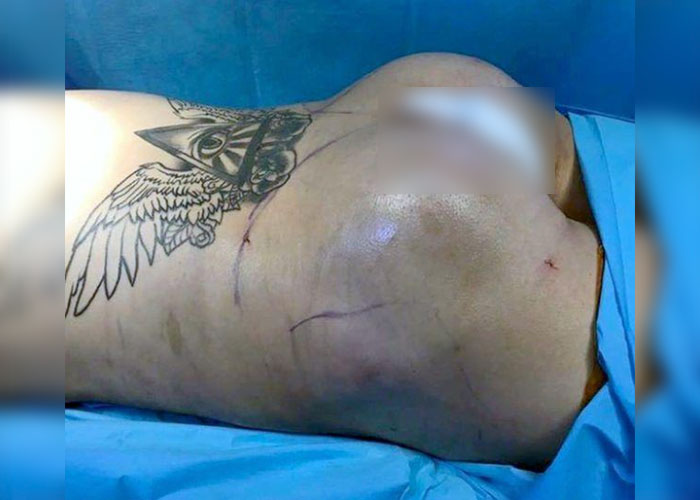 Fan de Kim Kardashian gastó 15 mil dólares para tener su trasero ...