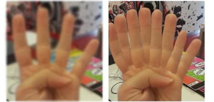 안경 쓴 사람은 공감하는 짜증나는 순간들