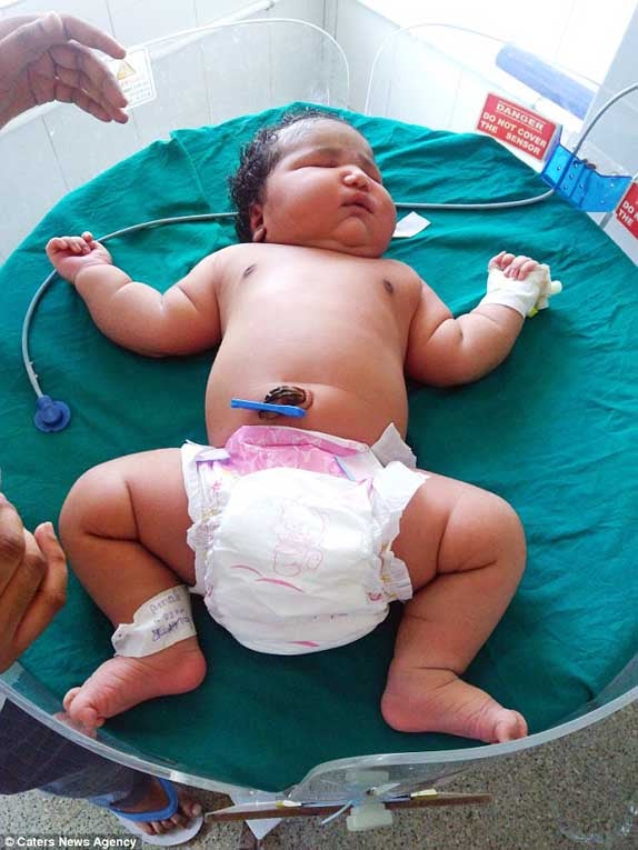 Bacalao con Papa: Nació la bebé mas grande del mundo: pesa casi 16 ...