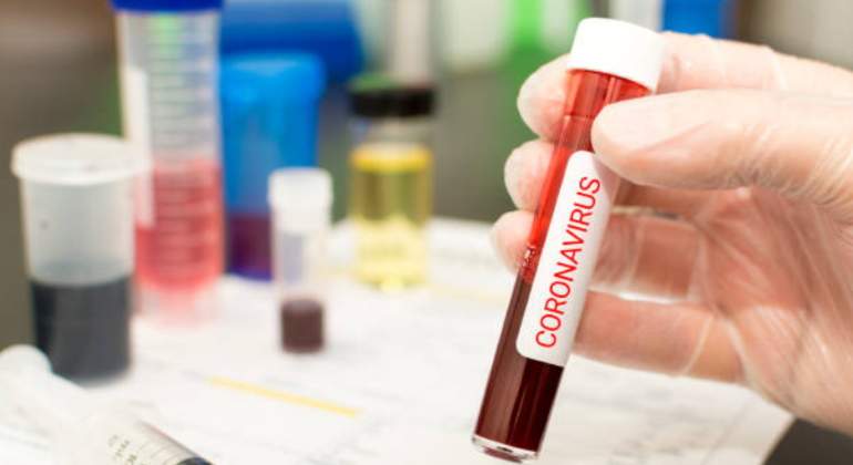 Las películas sobre contagios se vuelven virales en todo el mundo ...