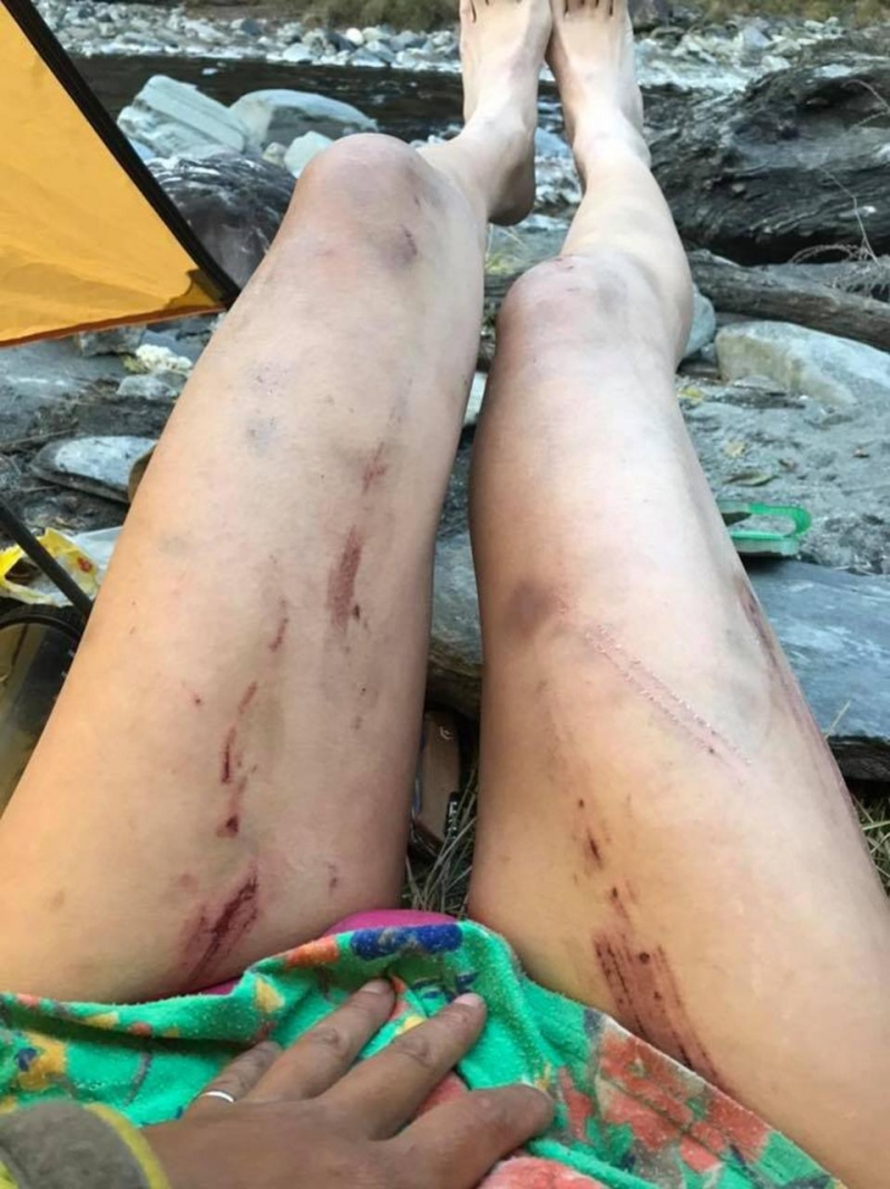 Mujer famosa por subir montañas en bikini muere de hipotermia ...