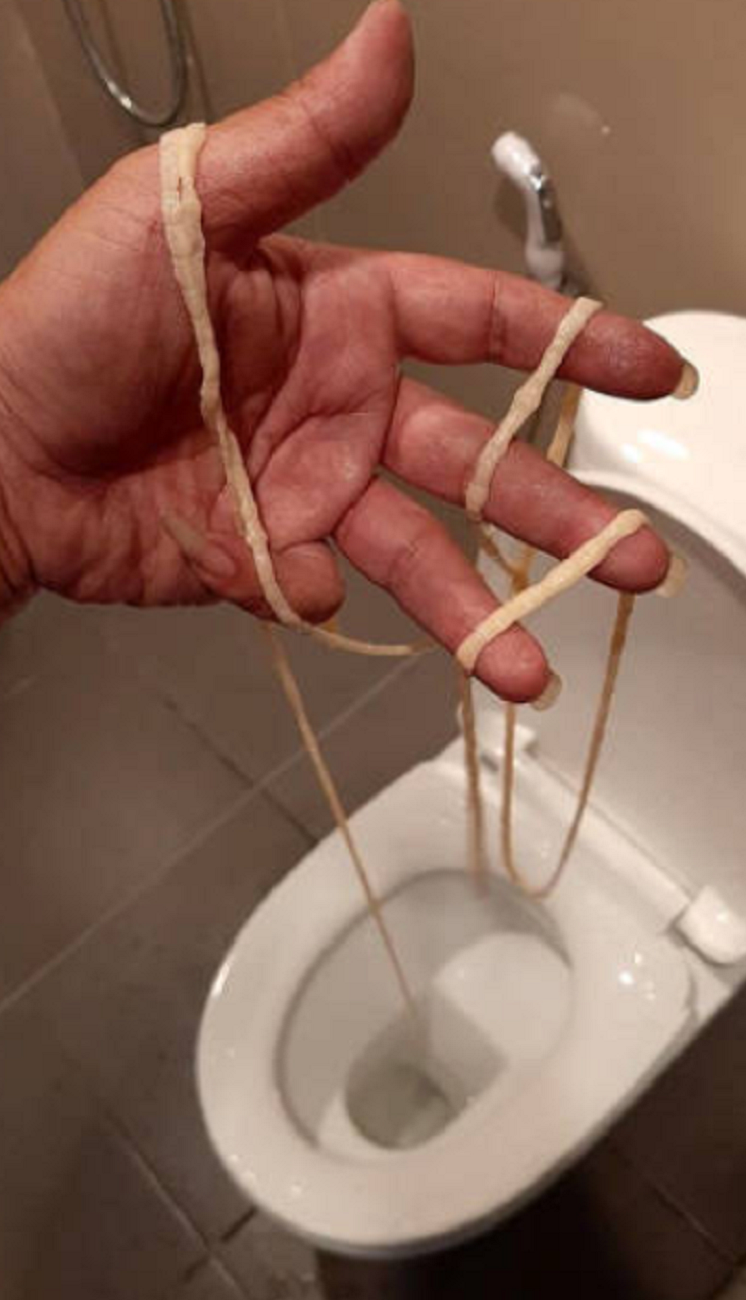 VÍDEO: Un hombre va al baño y expulsa un gusano gigante de 10 metros