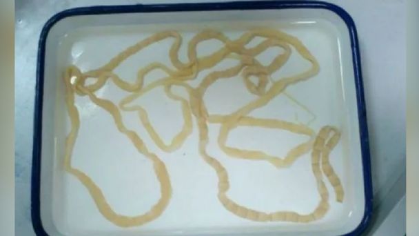 Hombre va al baño y termina por expulsar una lombriz de 10 metros ...