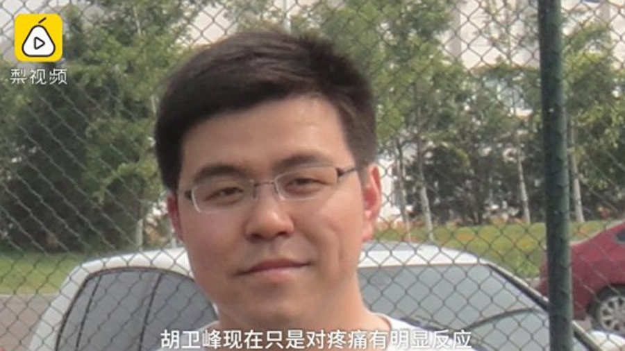 El extraño cambio de color de piel de médicos que sobrevivieron al ...